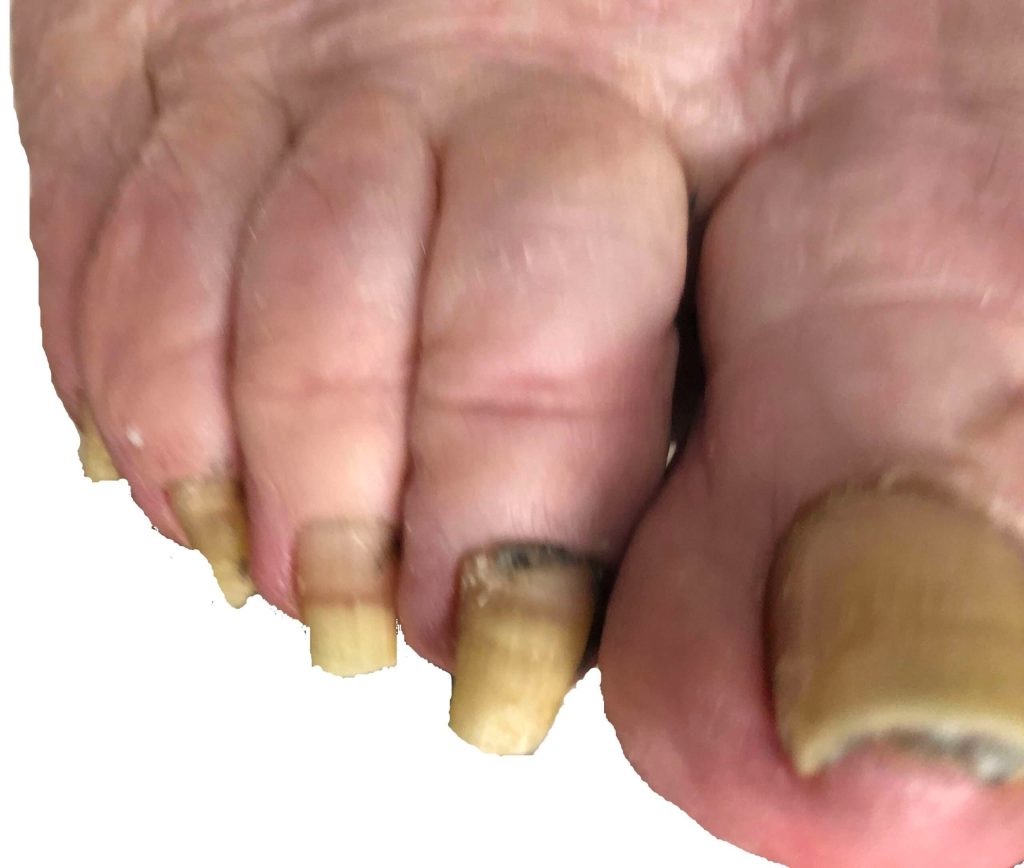 Footcare at your doorstep: finding real relief nearby