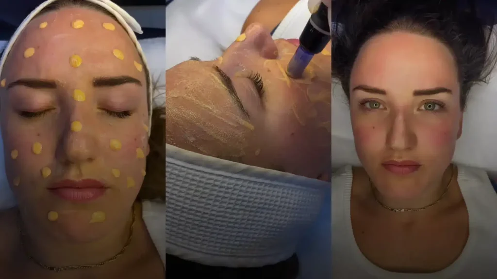 Transforming Scars with Medical Tattoos in Dubai