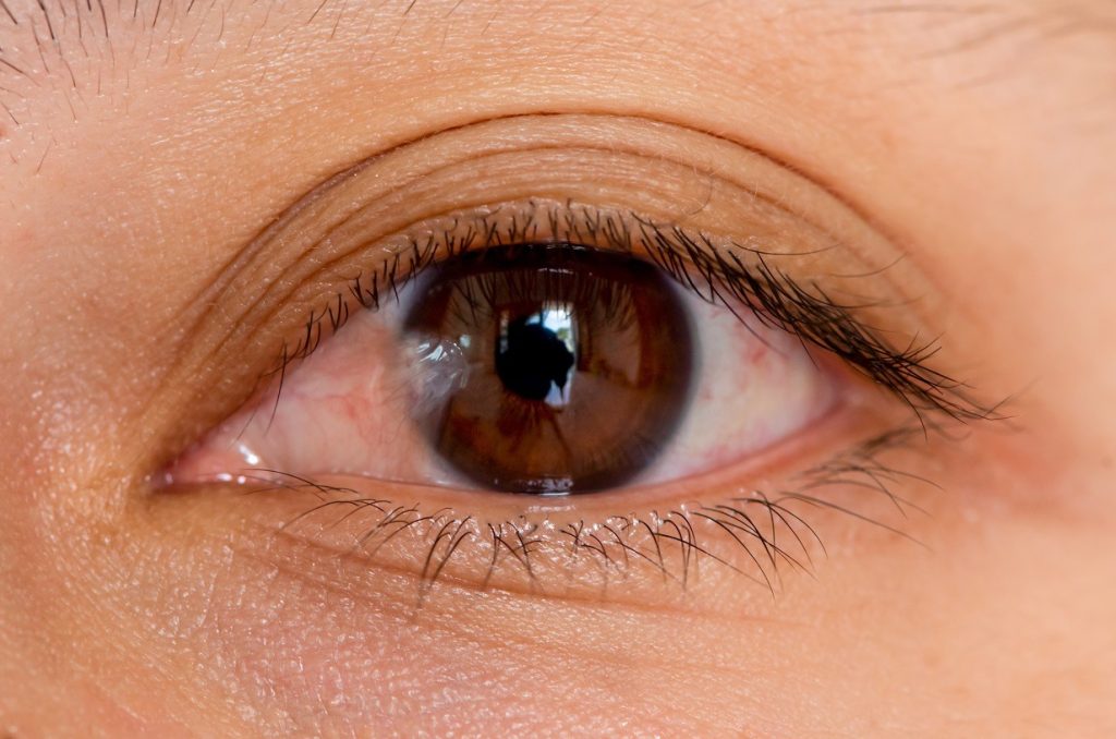 Visible Relief for Pterygium: Practical Home and Medical Tips