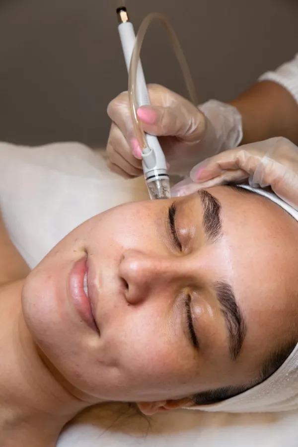 Effective Milia Treatments in Oakville: Safe, Skin-Softening Care Effective Milia Treatments in Oakville: Safe, Skin-Softening Care