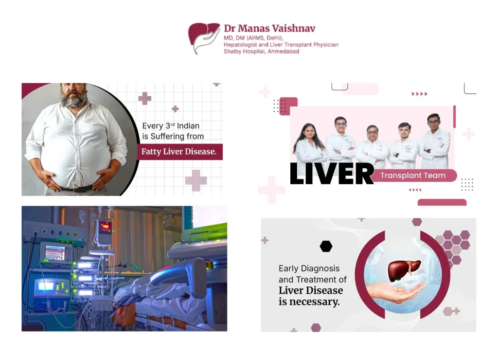 Comprehensive Liver Transplant in Gujarat | Expert Care and Support in Ahmedabad