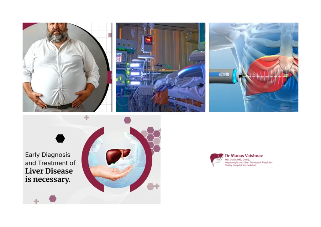 Expert Liver Transplant in Ahmedabad and Gujarat with Advanced Hepatology Care