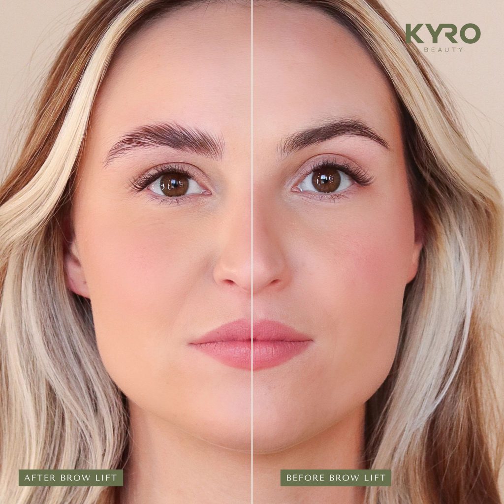 Fix Patchy Brows with a Simple Home Lamination Kit Fix Patchy Brows with a Simple Home Lamination Kit